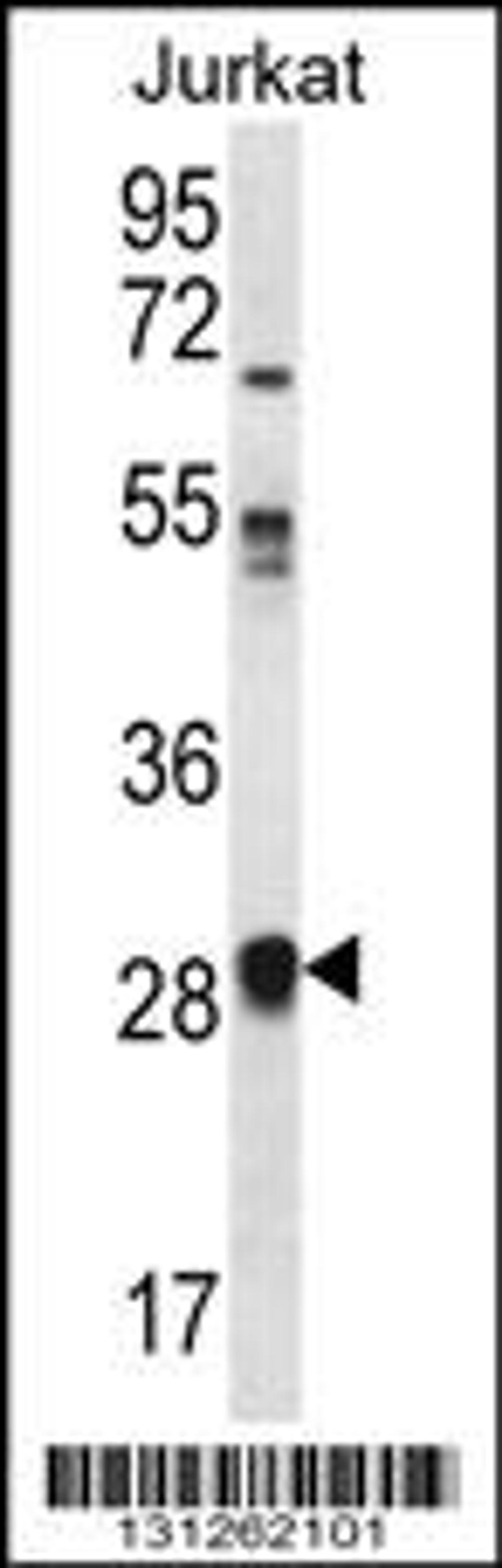 Western blot analysis in Jurkat cell line lysates (35ug/lane).