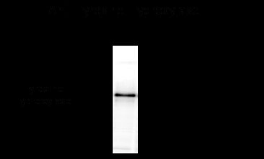 Tyrosine Hydroxylase, Sheep Antibody