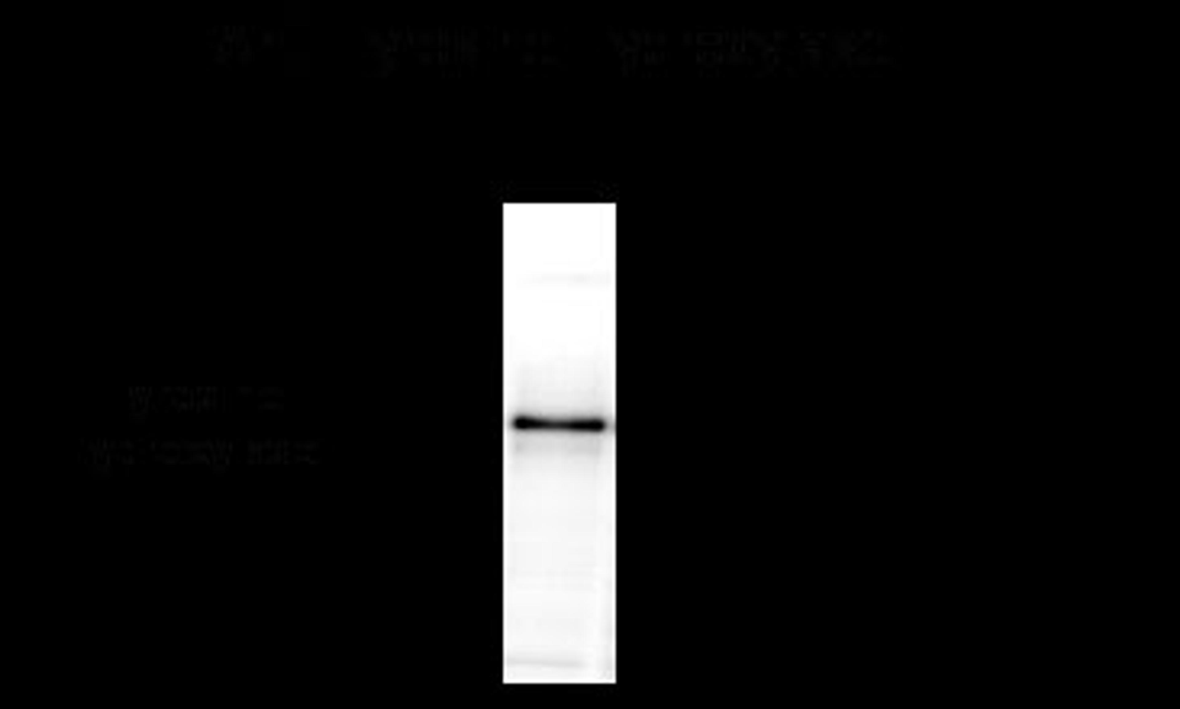 Tyrosine Hydroxylase, Sheep Antibody