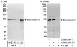 Detection of human Exonuclease 1 by western blot and immunoprecipitation.