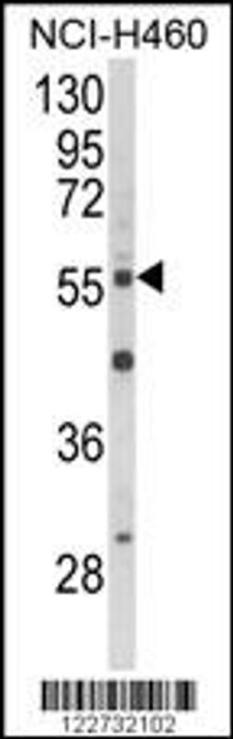 Western blot analysis of AKT2 Antibody in NCI-H460 cell line lysates (35ug/lane)