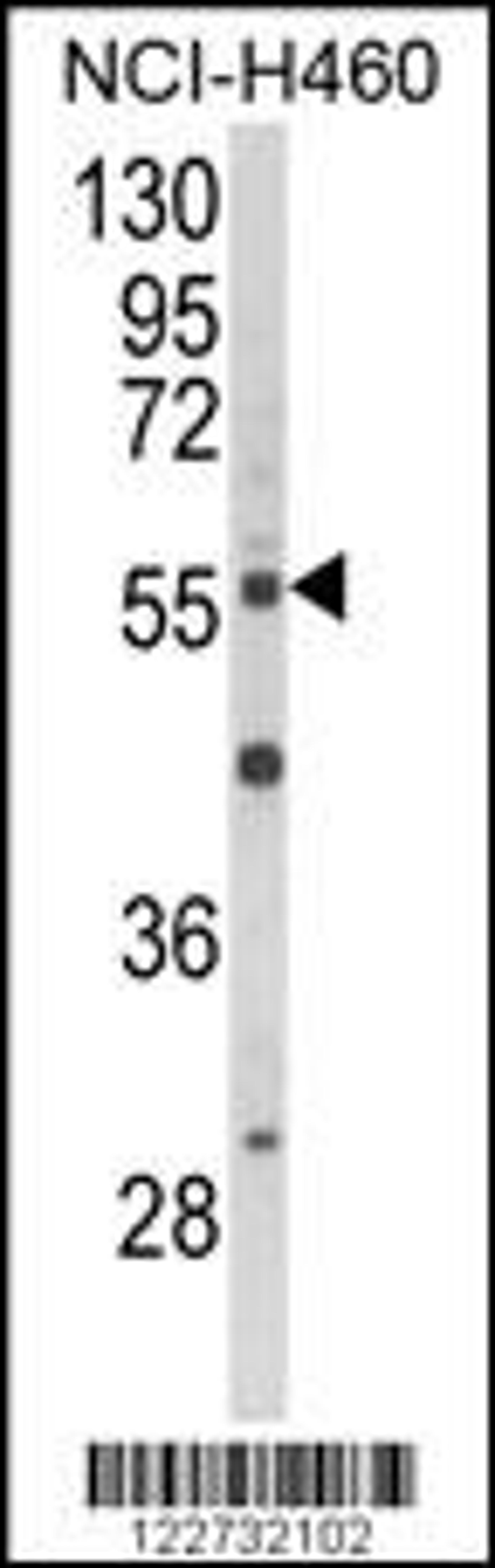 Western blot analysis of AKT2 Antibody in NCI-H460 cell line lysates (35ug/lane)