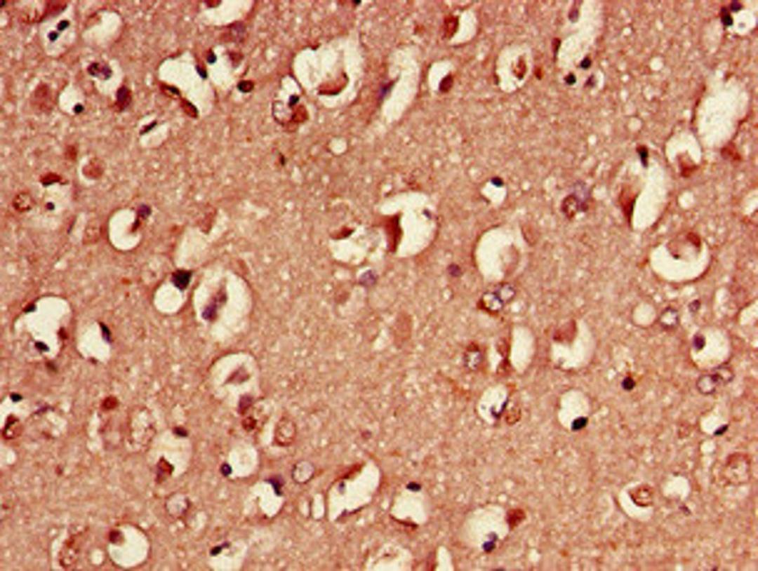Immunohistochemistry of paraffin-embedded human brain tissue using CSB-PA02174D0Rb at dilution of 1:100