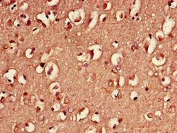 Immunohistochemistry of paraffin-embedded human brain tissue using CSB-PA02174D0Rb at dilution of 1:100