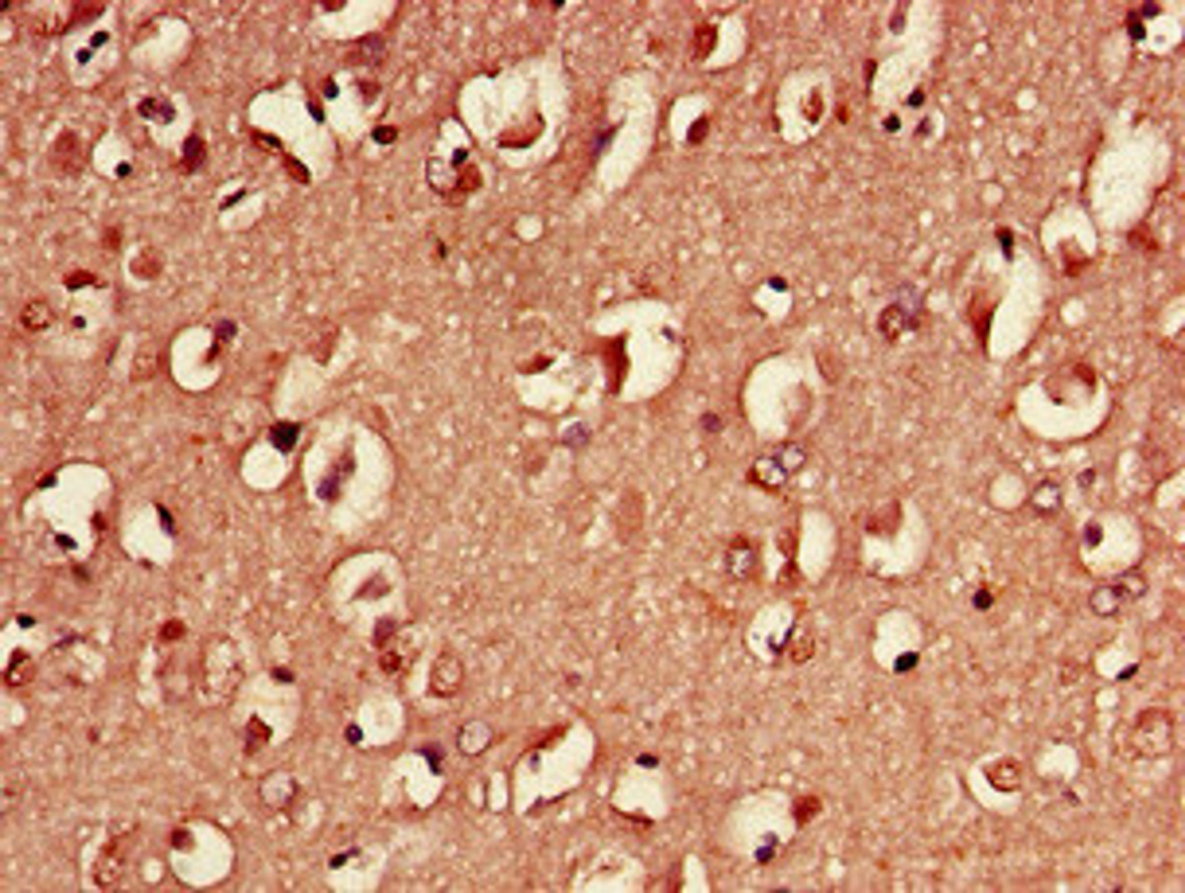 Immunohistochemistry of paraffin-embedded human brain tissue using CSB-PA02174D0Rb at dilution of 1:100
