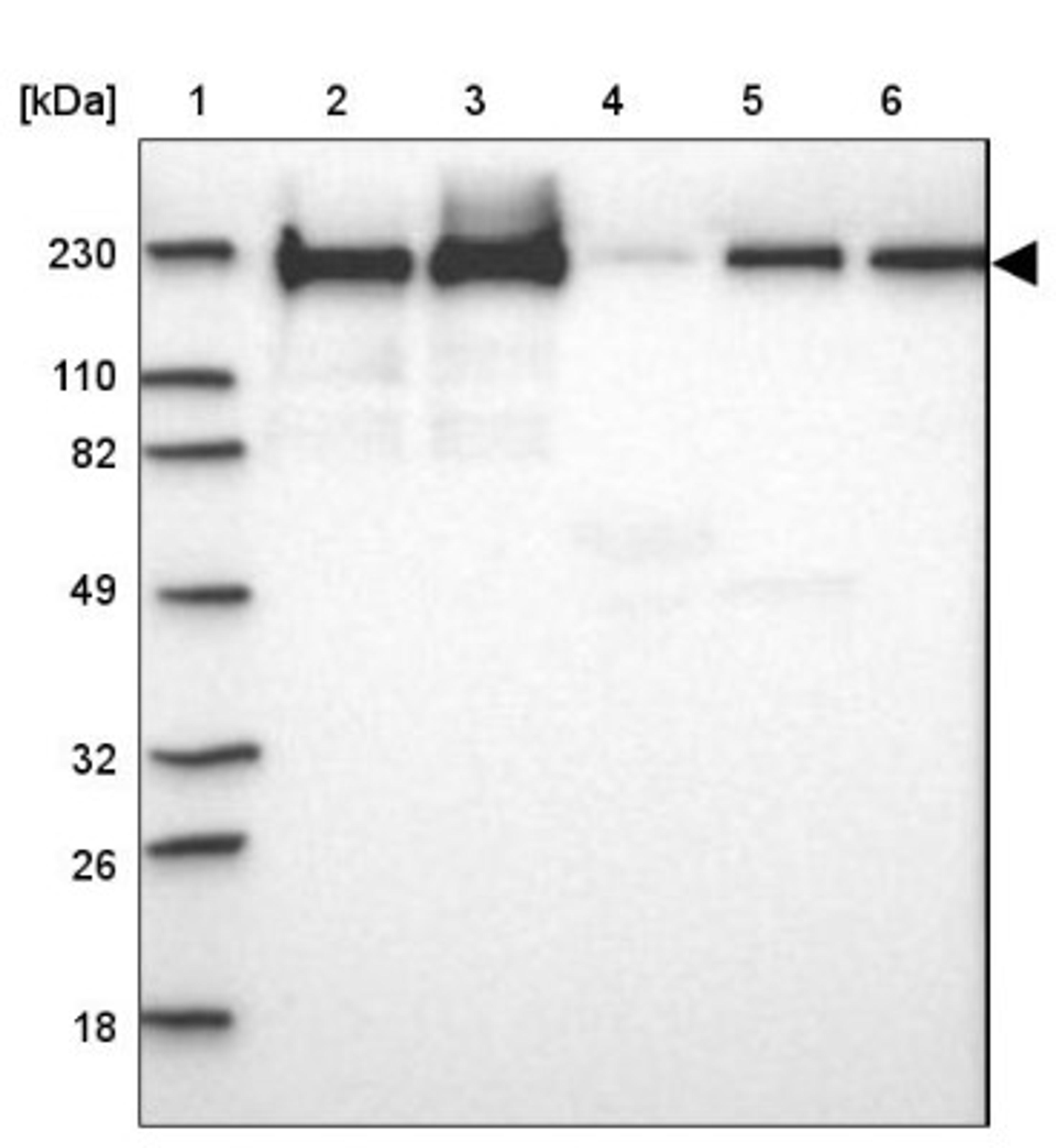 Western Blot: Filamin B Antibody [NBP1-90286] - Lane 1: Marker [kDa] 230, 110, 82, 49, 32, 26, 18<br/>Lane 2: Human cell line RT-4<br/>Lane 3: Human cell line U-251MG sp<br/>Lane 4: Human plasma (IgG/HSA depleted)<br/>Lane 5: Human liver tissue<br/>Lane 6: Human tonsil tissue