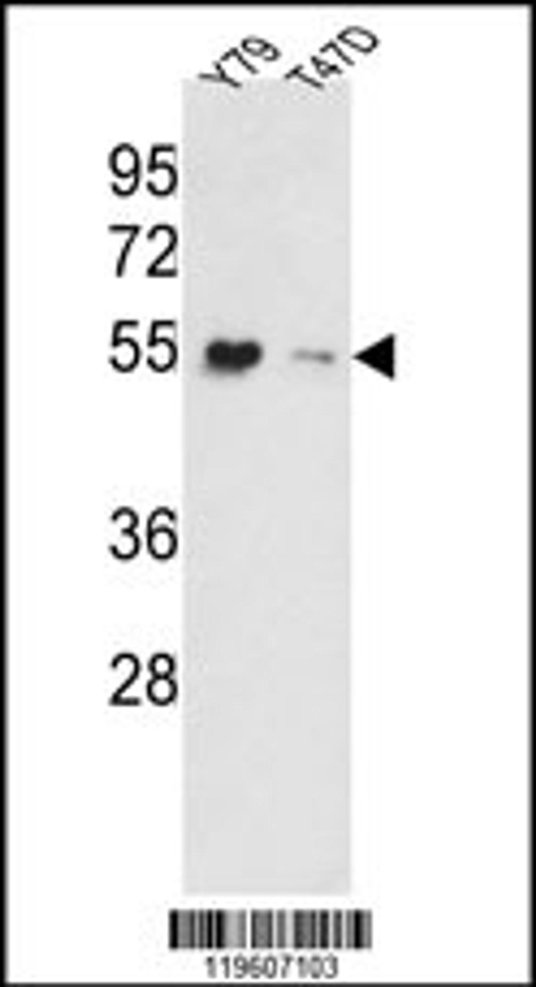 Western blot analysis of EEF1A1/ EEF1A2 Antibody in Y79, T47D cell line lysates (35ug/lane).