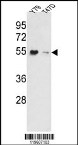 Western blot analysis of EEF1A1/ EEF1A2 Antibody in Y79, T47D cell line lysates (35ug/lane).