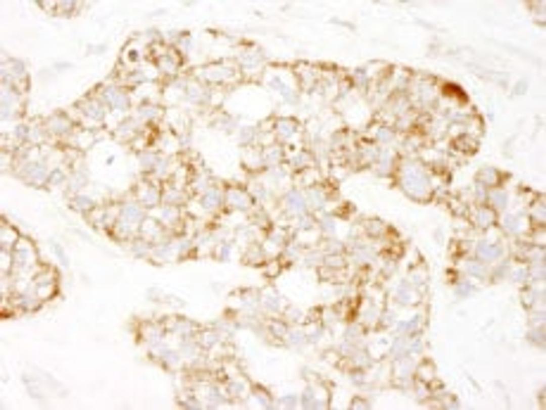 Detection of human Prohibitin by immunohistochemistry.