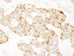 Detection of human Prohibitin by immunohistochemistry.