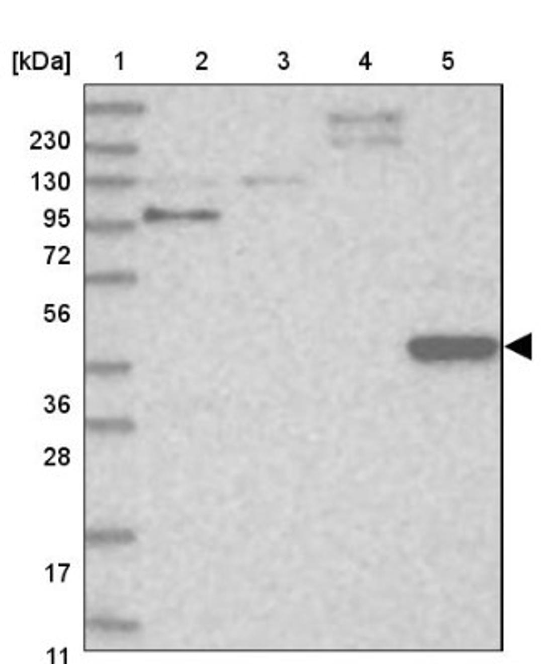 Western Blot: PPP1R36 Antibody [NBP1-85888] - Lane 1: Marker [kDa] 230, 130, 95, 72, 56, 36, 28, 17, 11<br/>Lane 2: Human cell line RT-4<br/>Lane 3: Human cell line U-251MG sp<br/>Lane 4: Human plasma (IgG/HSA depleted)<br/>Lane 5: Human liver tissue