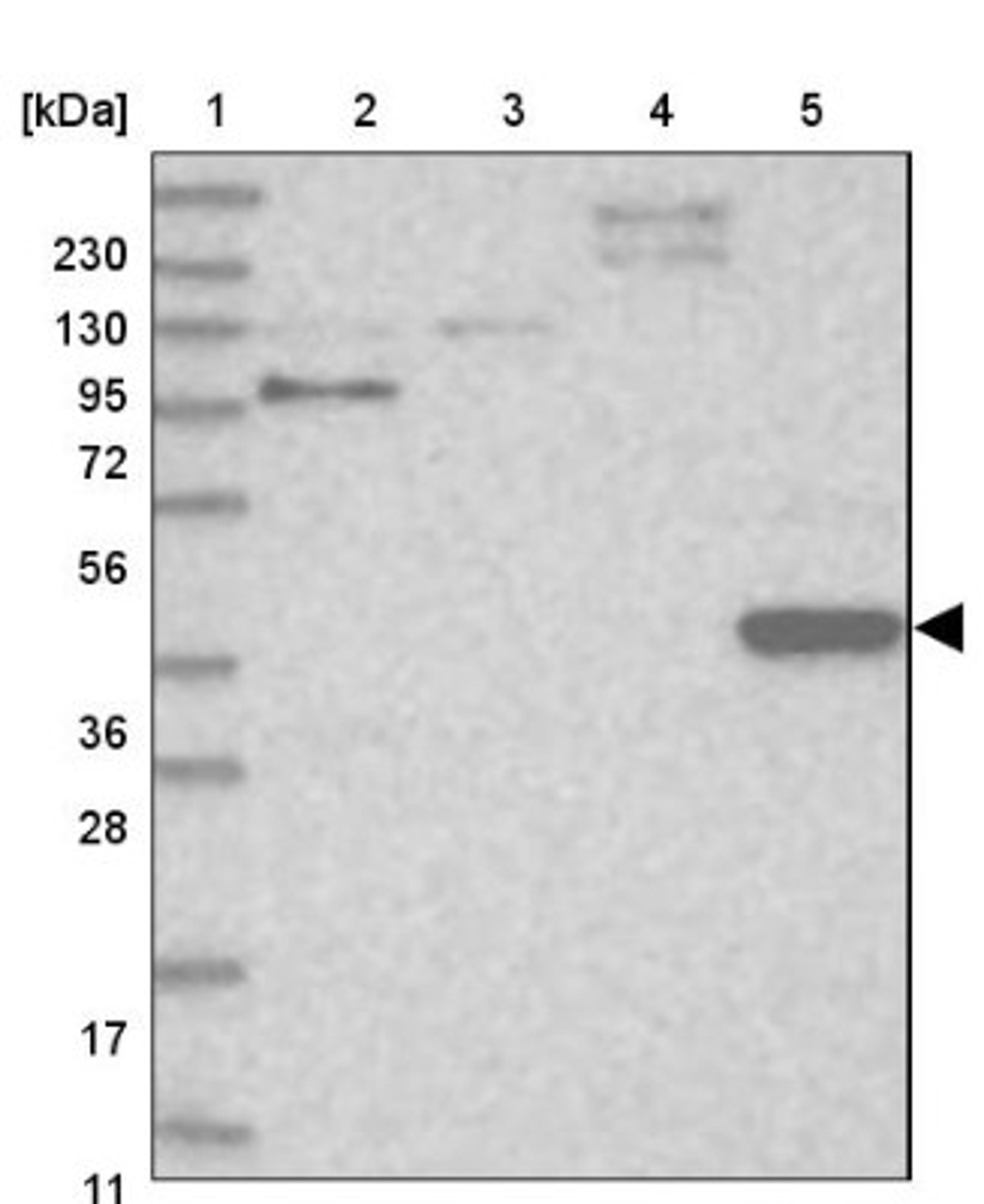 Western Blot: PPP1R36 Antibody [NBP1-85888] - Lane 1: Marker [kDa] 230, 130, 95, 72, 56, 36, 28, 17, 11<br/>Lane 2: Human cell line RT-4<br/>Lane 3: Human cell line U-251MG sp<br/>Lane 4: Human plasma (IgG/HSA depleted)<br/>Lane 5: Human liver tissue