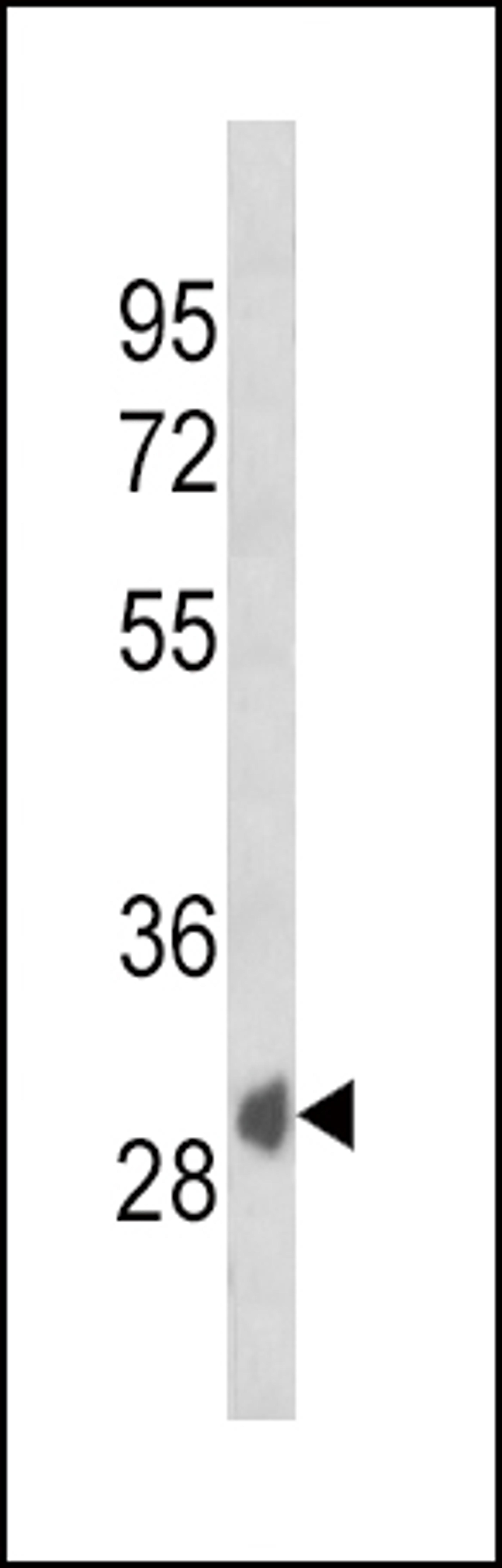 Western blot analysis of SFRP1 Antibody in K562 cell line lysates (35ug/lane)