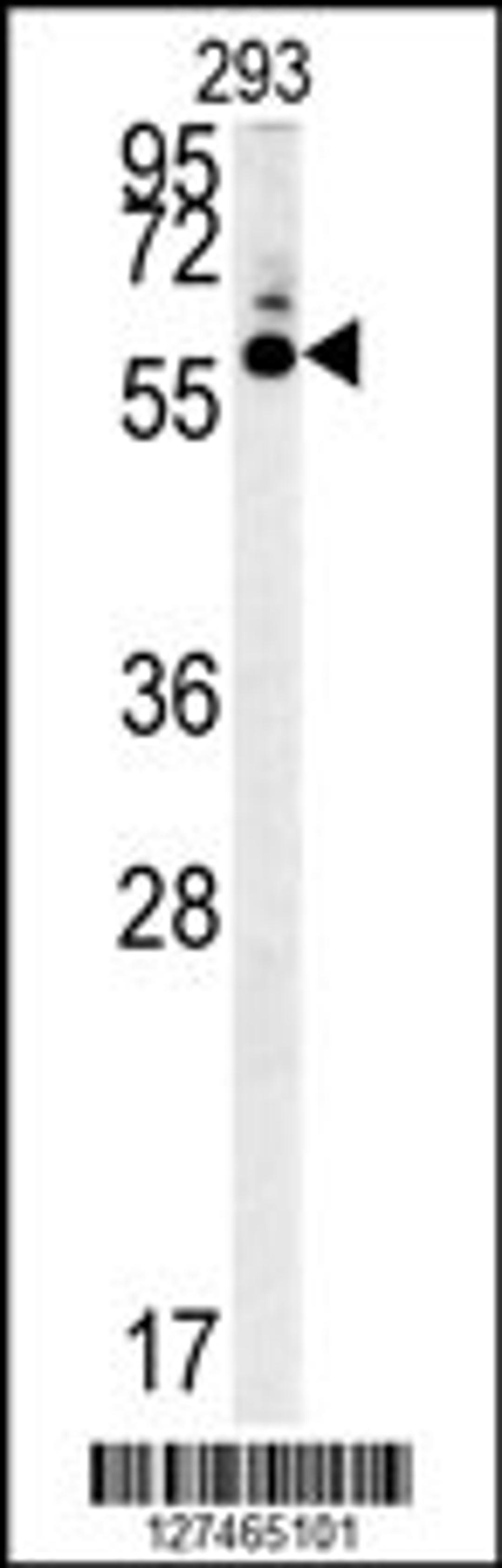 Western blot analysis in 293 cell line lysates (35ug/lane).