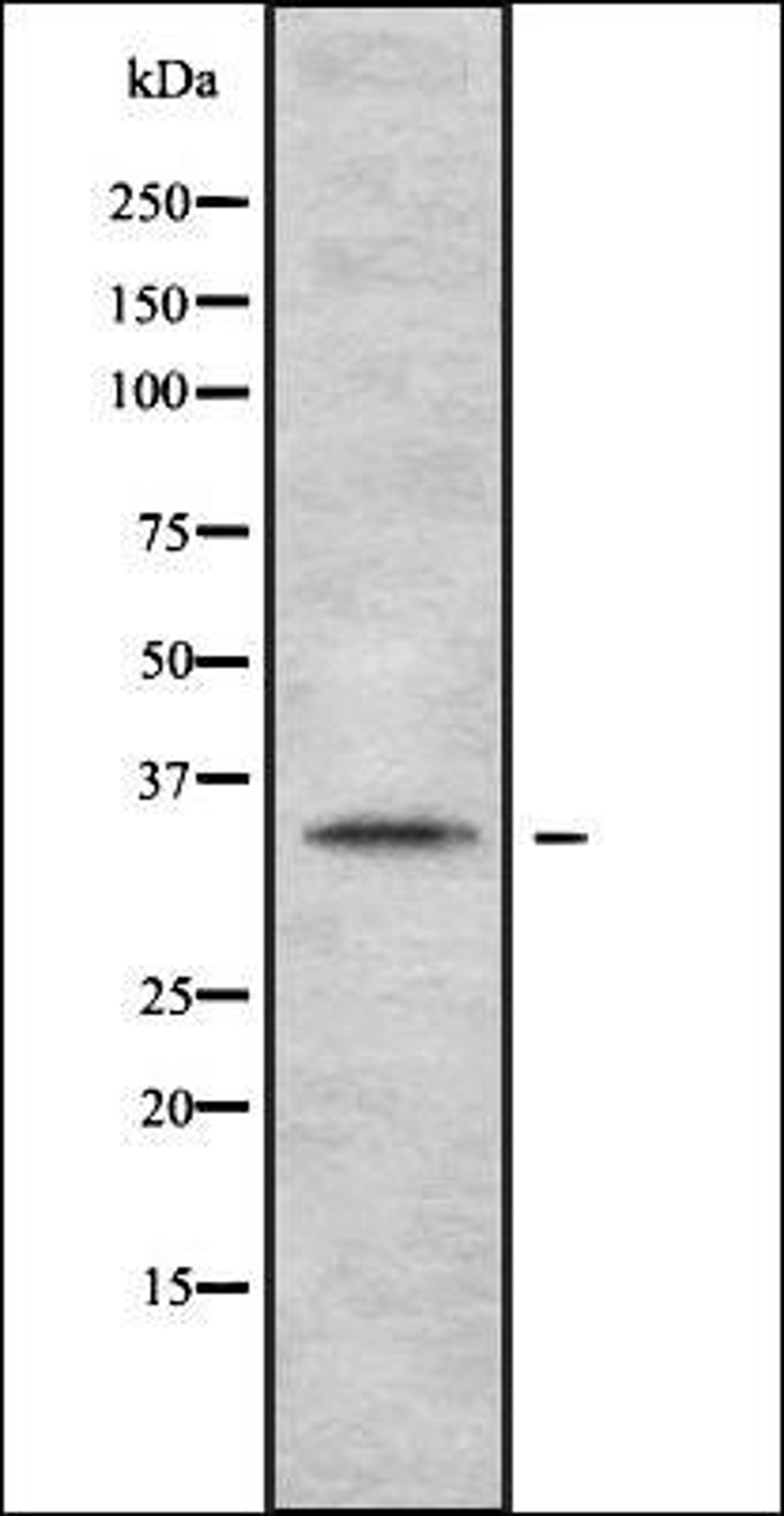 Western blot analysis of HEK293 cells using OR2A2 antibody