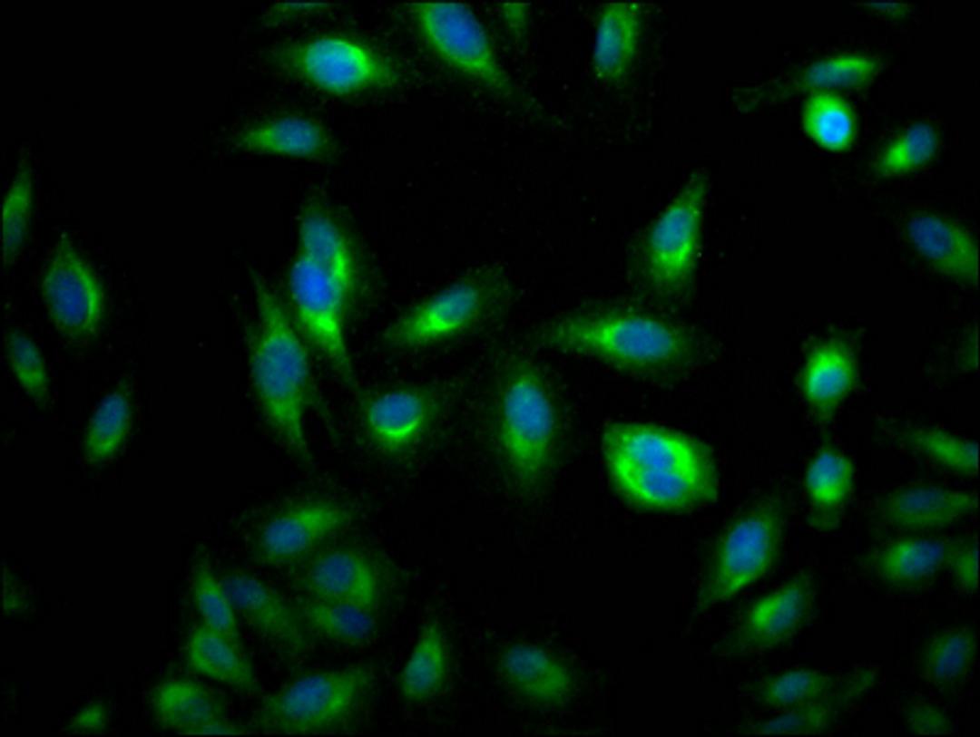 Immunofluorescence staining of Hela Cells with CSB-RA170650A0HU at 1:50, counter-stained with DAPI. The cells were fixed in 4% formaldehyde, permeated by 0.2% TritonX-100, and blocked in 10% normal Goat Serum. The cells were then incubated with the antibody overnight at 4℃. Nuclear DNA was labeled in blue with DAPI. The secondary antibody was FITC-conjugated AffiniPure Goat Anti-Rabbit IgG (H+L).