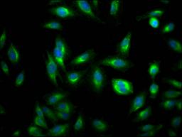 Immunofluorescence staining of Hela Cells with CSB-RA170650A0HU at 1:50, counter-stained with DAPI. The cells were fixed in 4% formaldehyde, permeated by 0.2% TritonX-100, and blocked in 10% normal Goat Serum. The cells were then incubated with the antibody overnight at 4℃. Nuclear DNA was labeled in blue with DAPI. The secondary antibody was FITC-conjugated AffiniPure Goat Anti-Rabbit IgG (H+L).