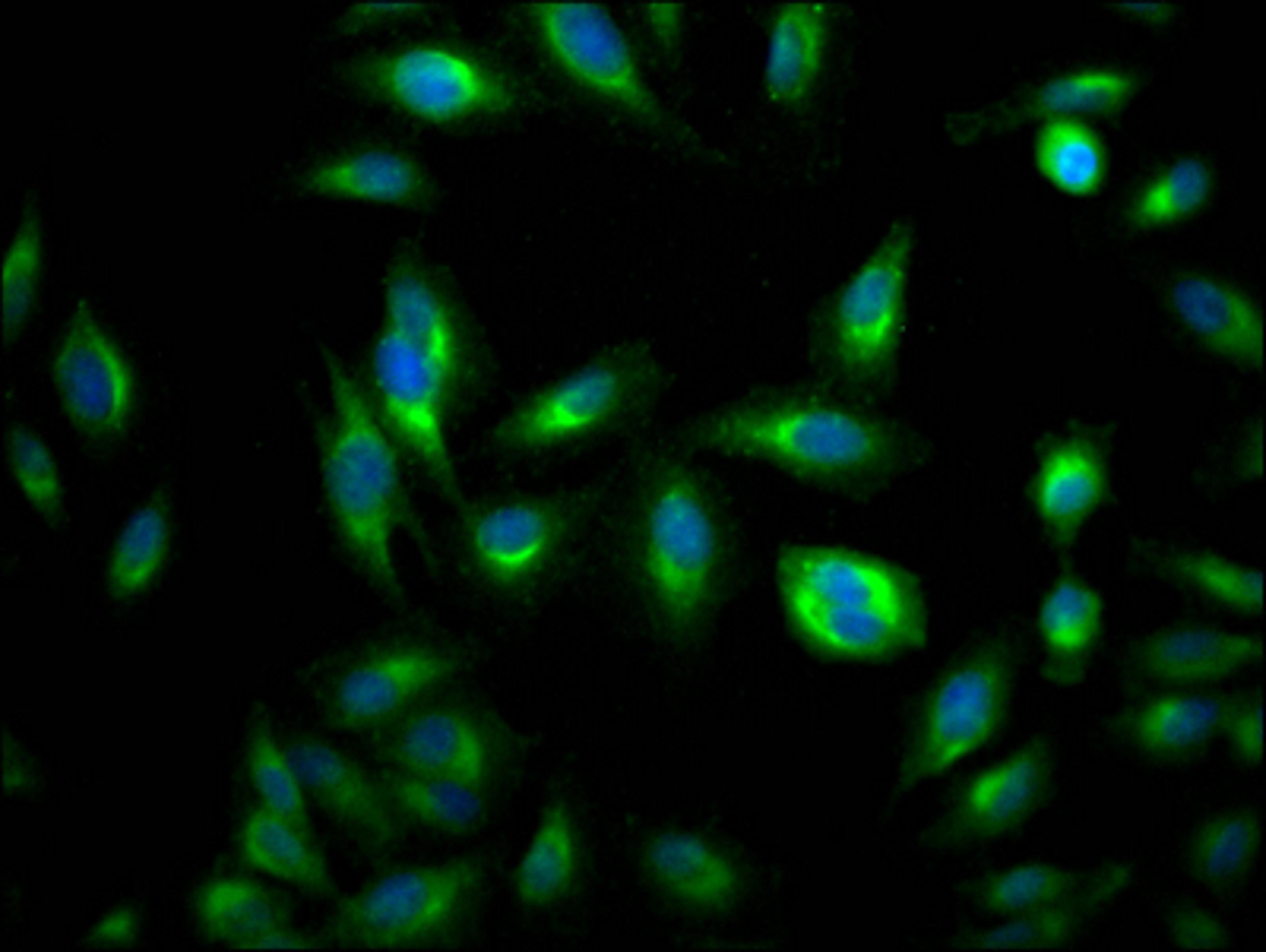 Immunofluorescence staining of Hela Cells with CSB-RA170650A0HU at 1:50, counter-stained with DAPI. The cells were fixed in 4% formaldehyde, permeated by 0.2% TritonX-100, and blocked in 10% normal Goat Serum. The cells were then incubated with the antibody overnight at 4℃. Nuclear DNA was labeled in blue with DAPI. The secondary antibody was FITC-conjugated AffiniPure Goat Anti-Rabbit IgG (H+L).