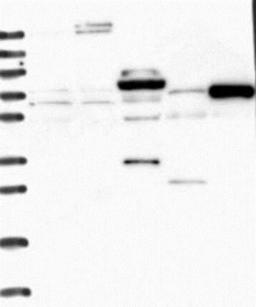 Western Blot: ODF3 Antibody [NBP2-32628] - Lane 1: Marker [kDa] 250, 130, 95, 72, 55, 36, 28, 17, 10 | Lane 2: Negative control (vector only transfected HEK293T lysate) | Lane 3: Over-expression Lysate (Co-expressed with a C-terminal myc-DDK tag (~3.1 kDa) in mammalian HEK293T cells, <a href="http