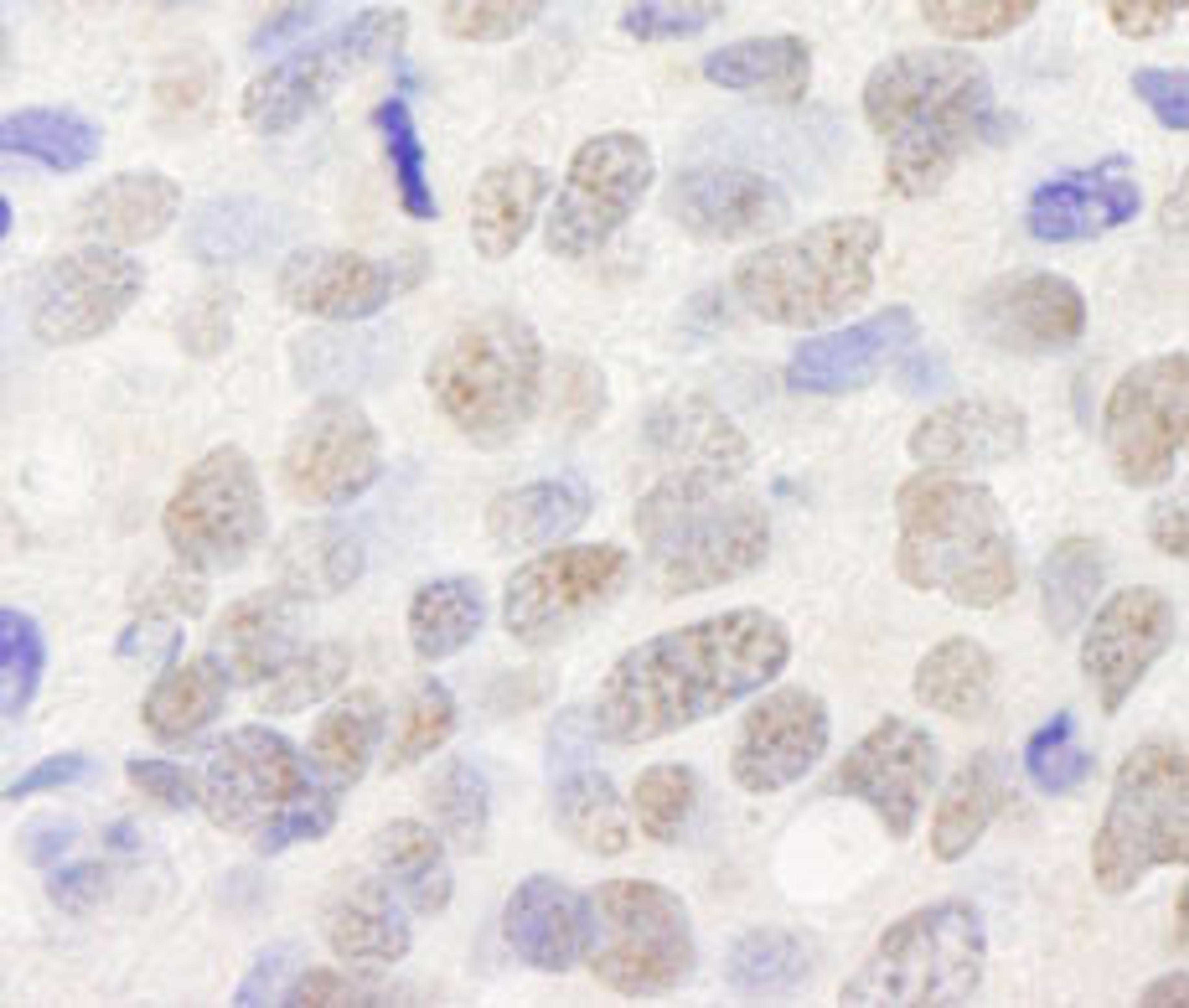 Detection of human TIF1 Alpha / TRIM24 by immunohistochemistry.