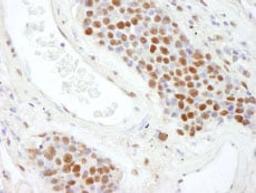 Detection of human SAFB2 by immunohistochemistry.