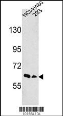 Western blot analysis of hEPHA3-D130 in NCI-H460,293 cell line lysates (35ug/lane)