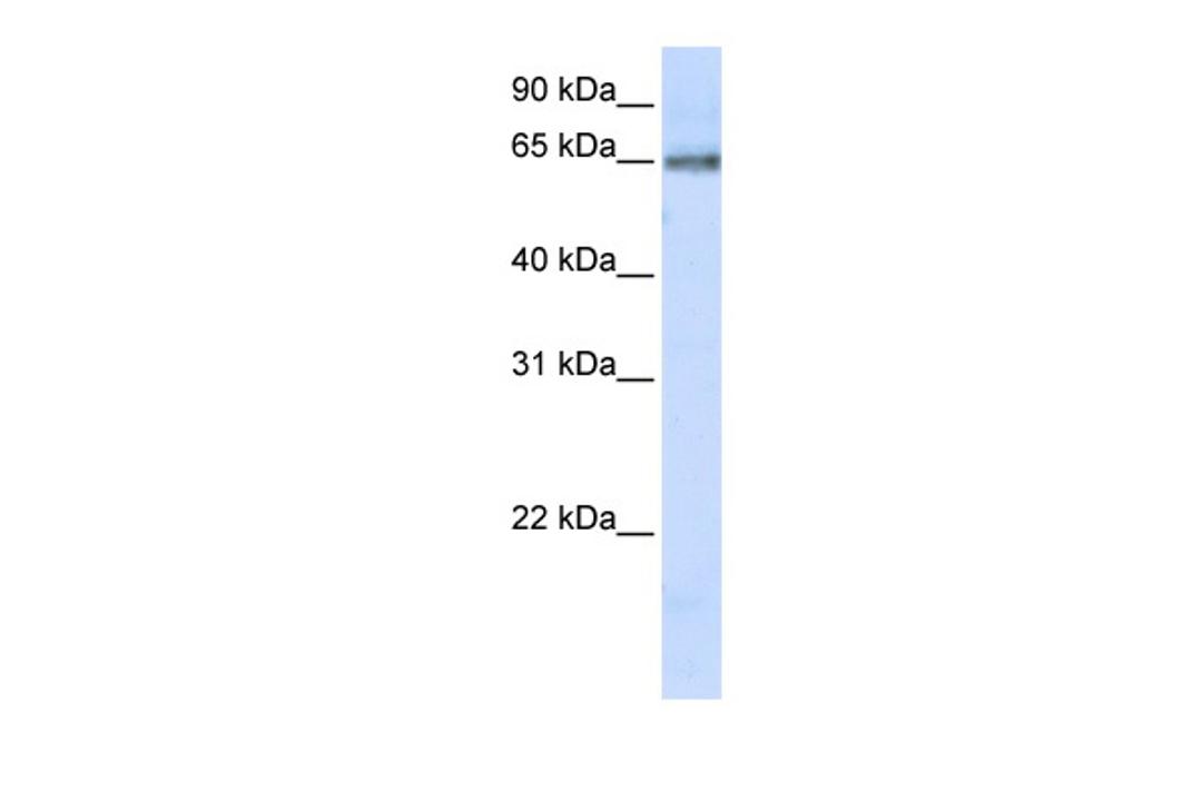 Antibody used in WB on Human 293T at 0.2-1 ug/ml.