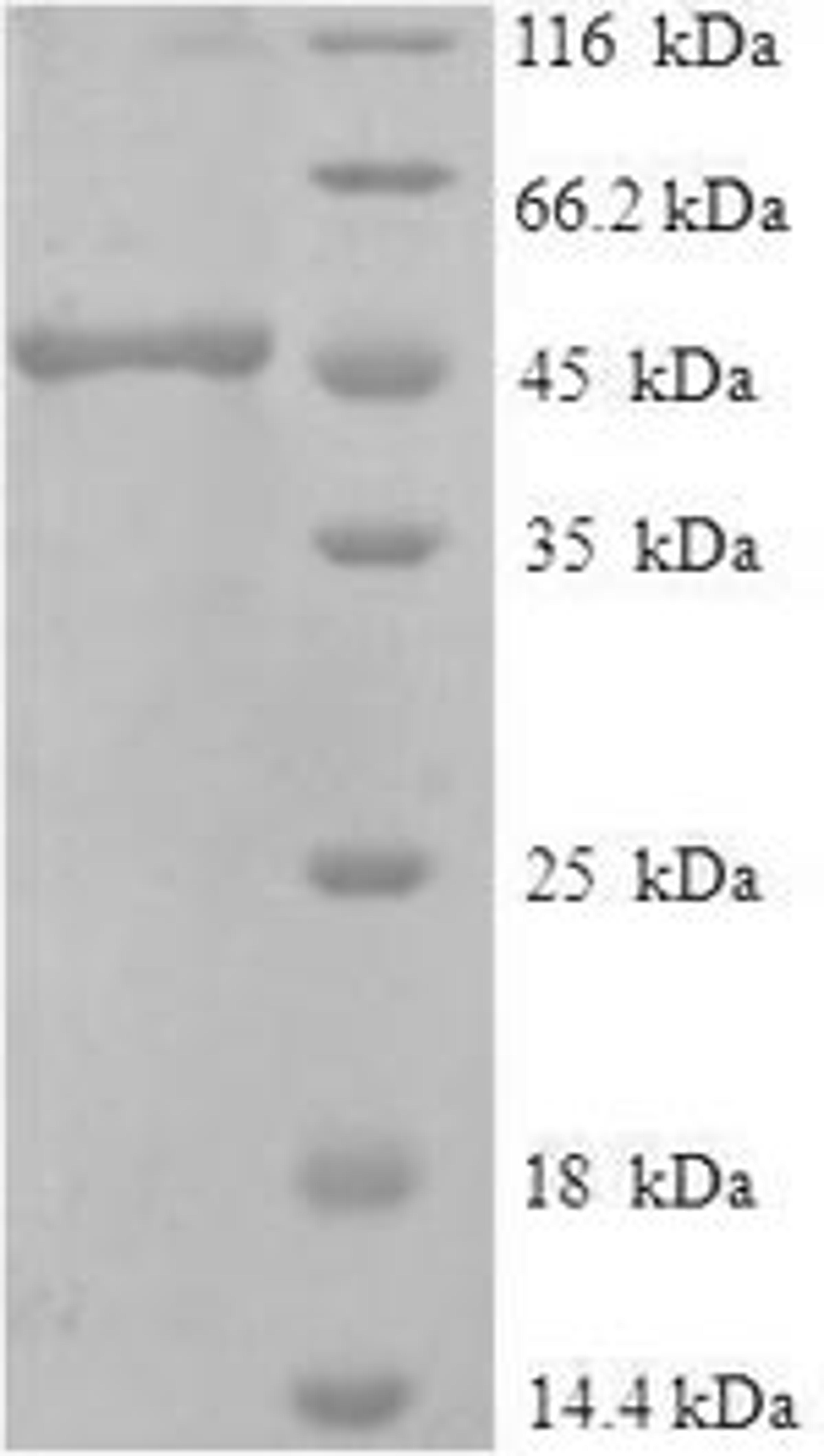 (Tris-Glycine gel) Discontinuous SDS-PAGE (reduced) with 5% enrichment gel and 15% separation gel.