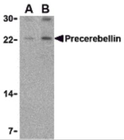 Western blot analysis of precerebellin in mouse cerebellum lysate with precerebellin antibody at (A) 2 and (B) 4 &#956;g/mL.