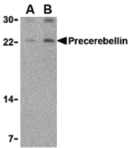 Western blot analysis of precerebellin in mouse cerebellum lysate with precerebellin antibody at (A) 2 and (B) 4 μg/mL.