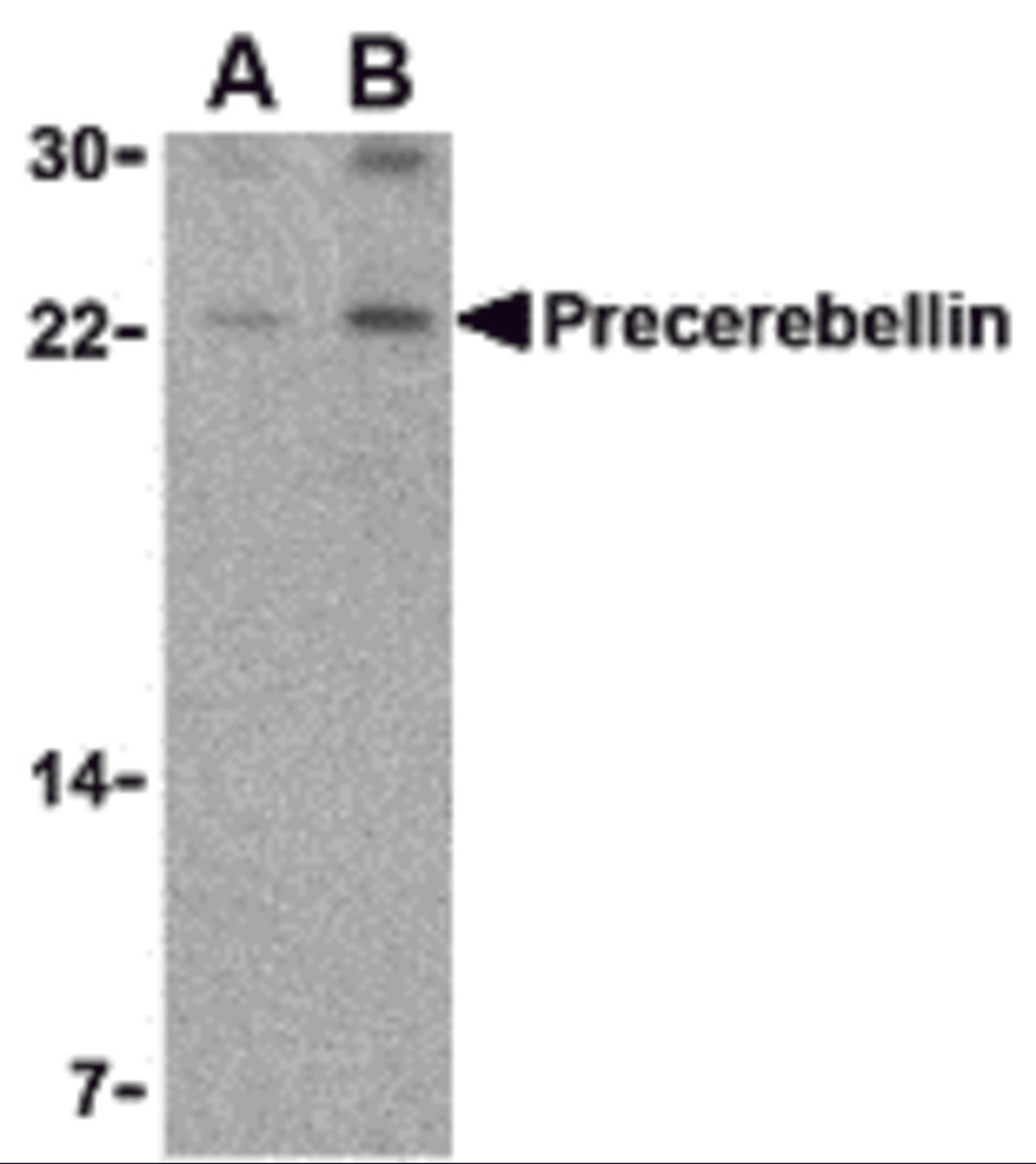 Western blot analysis of precerebellin in mouse cerebellum lysate with precerebellin antibody at (A) 2 and (B) 4 μg/mL.