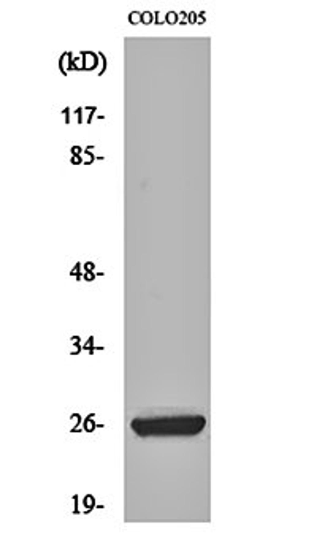 Western blot analysis of COLO205 cell lysates using HMG-2 antibody