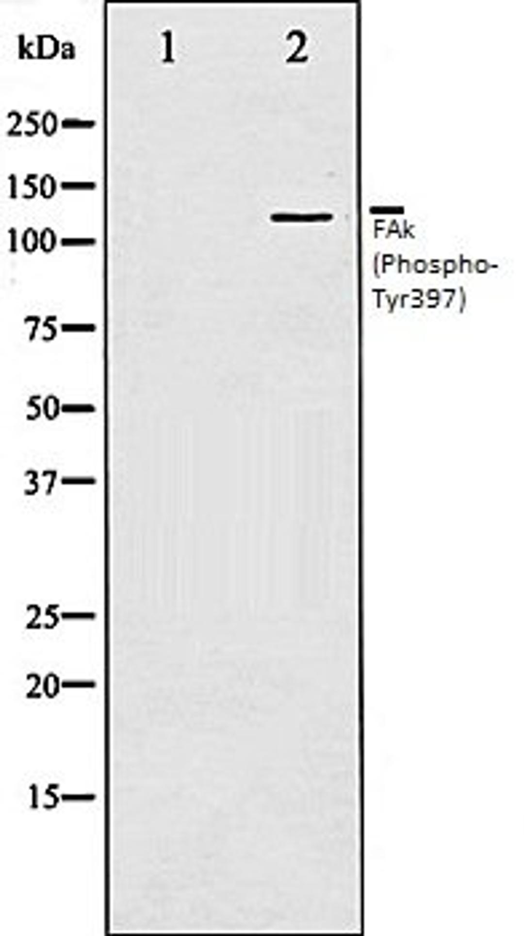 Western blot analysis of 293 whole cell lysates using FAK (Phospho-Tyr397) antibody, The lane on the left is treated with the antigen-specific peptide.