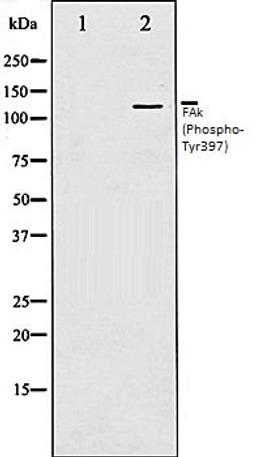 Western blot analysis of 293 whole cell lysates using FAK (Phospho-Tyr397) antibody, The lane on the left is treated with the antigen-specific peptide.