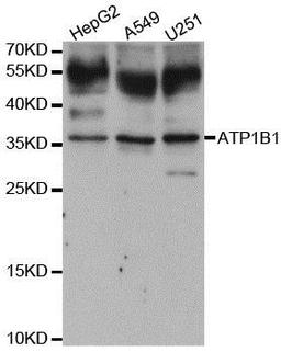 Western blot analysis of extracts of various cell lines using ATP1B1 antibody