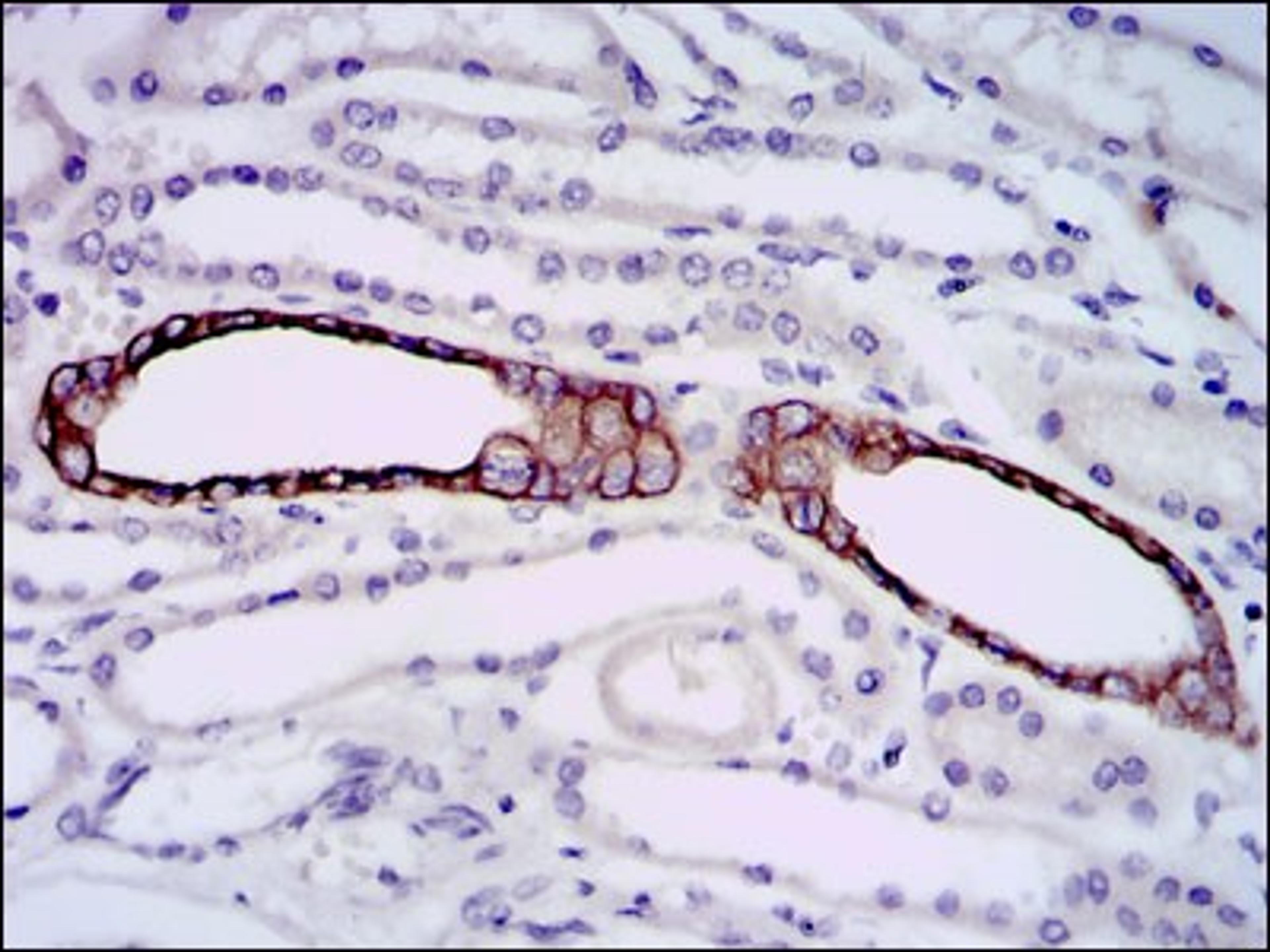 Immunohistochemistry: PSP/bpifa2 Antibody (1F12) [NBP2-37493] - Immunohistochemical analysis of paraffin-embedded kidney tissues using mouse Splunc2 mouse mAb with DAB staining.