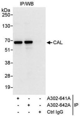 Detection of human CAL by western blot of immunoprecipitates.