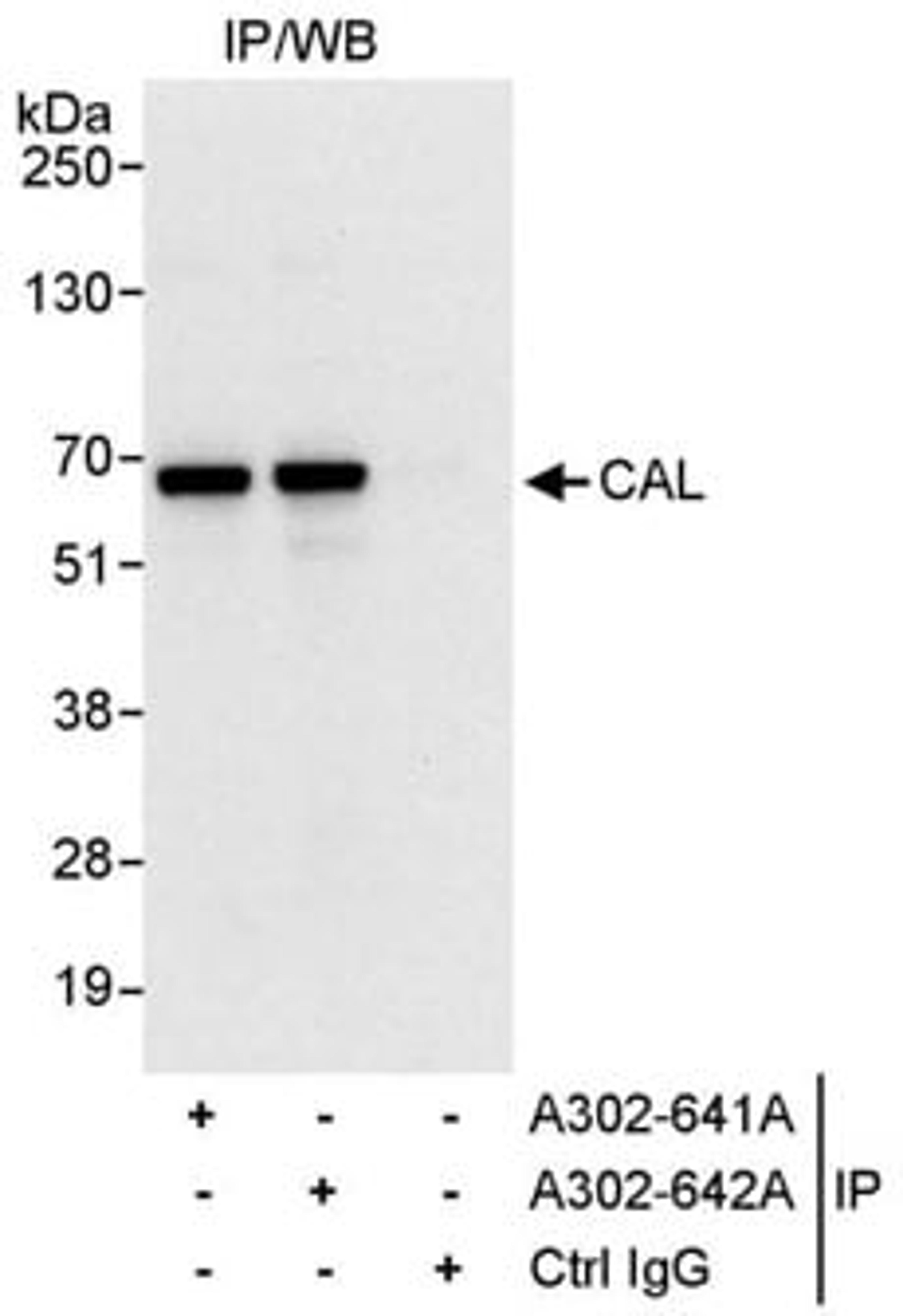 Detection of human CAL by western blot of immunoprecipitates.