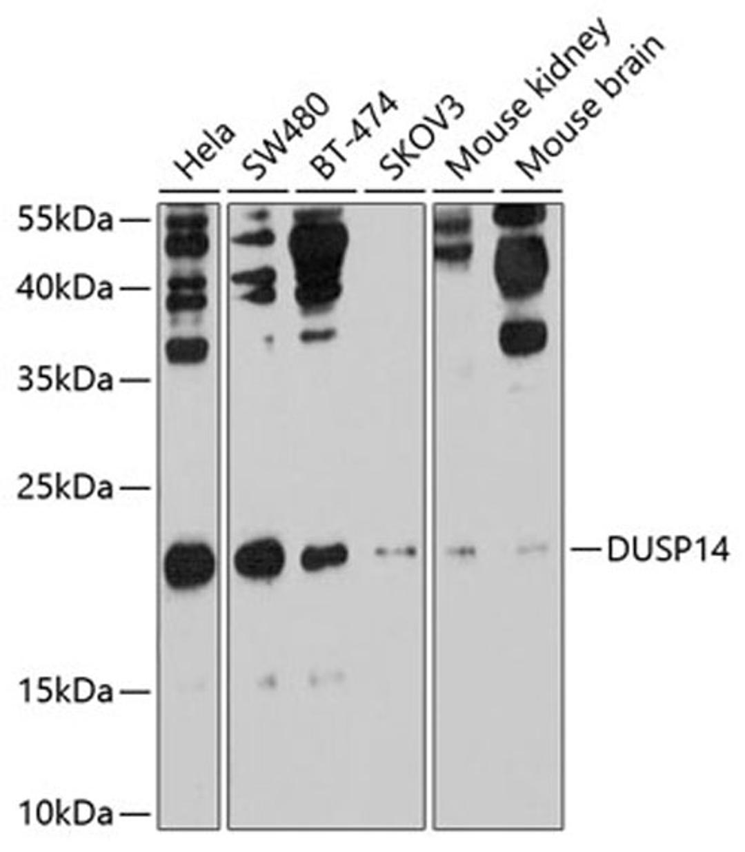 Western blot - DUSP14 antibody (A10287)