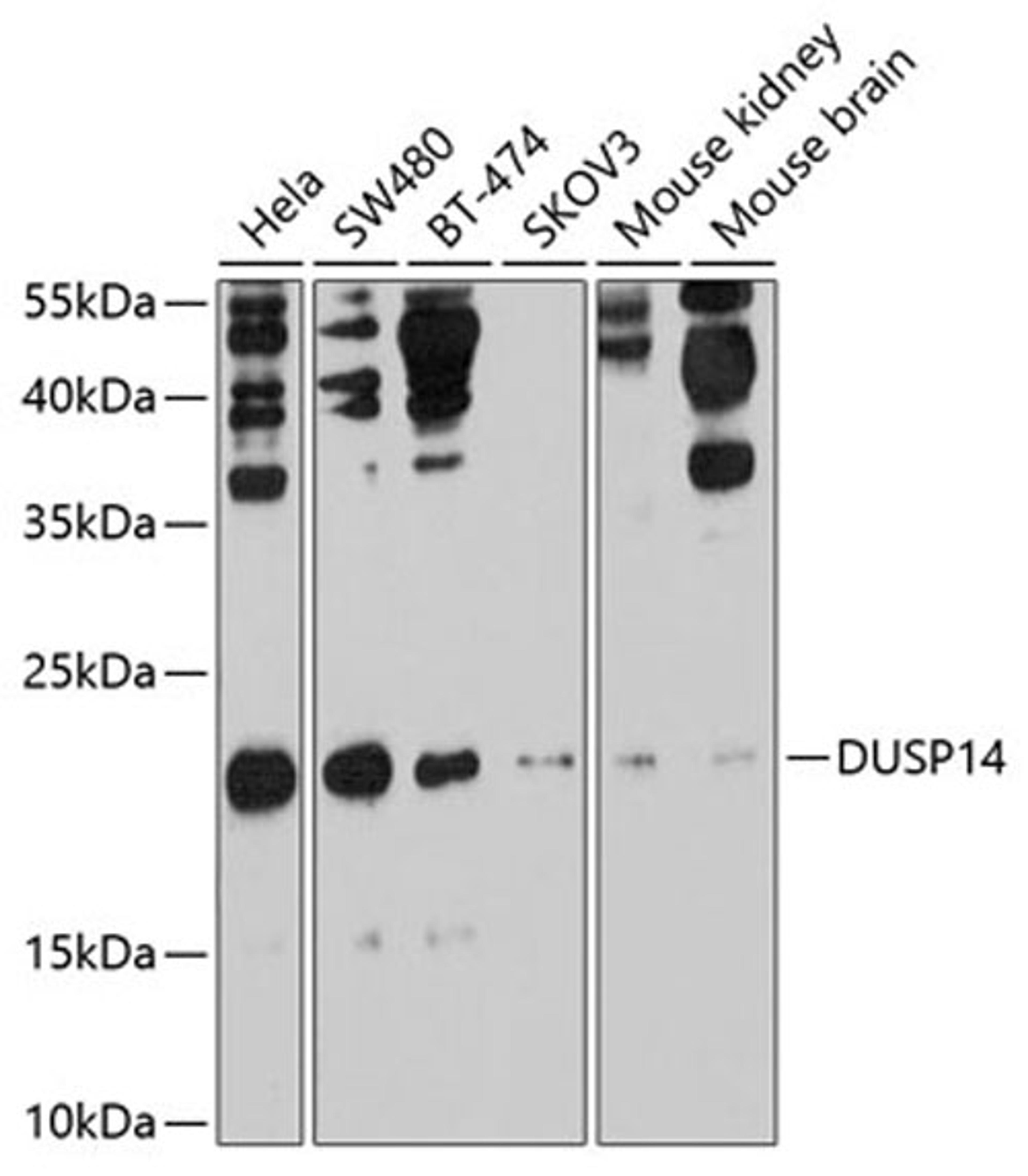 Western blot - DUSP14 antibody (A10287)