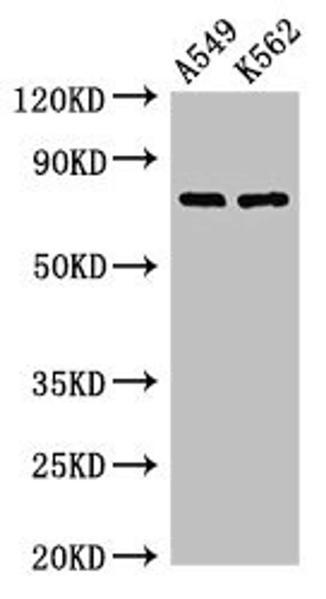Western Blot. Positive WB detected in: A549 whole cell lysate, K562 whole cell lysate. All lanes: POLH antibody at 2.8µg/ml. Secondary. Goat polyclonal to rabbit IgG at 1/50000 dilution. Predicted band size: 79, 47 kDa. Observed band size: 79 kDa