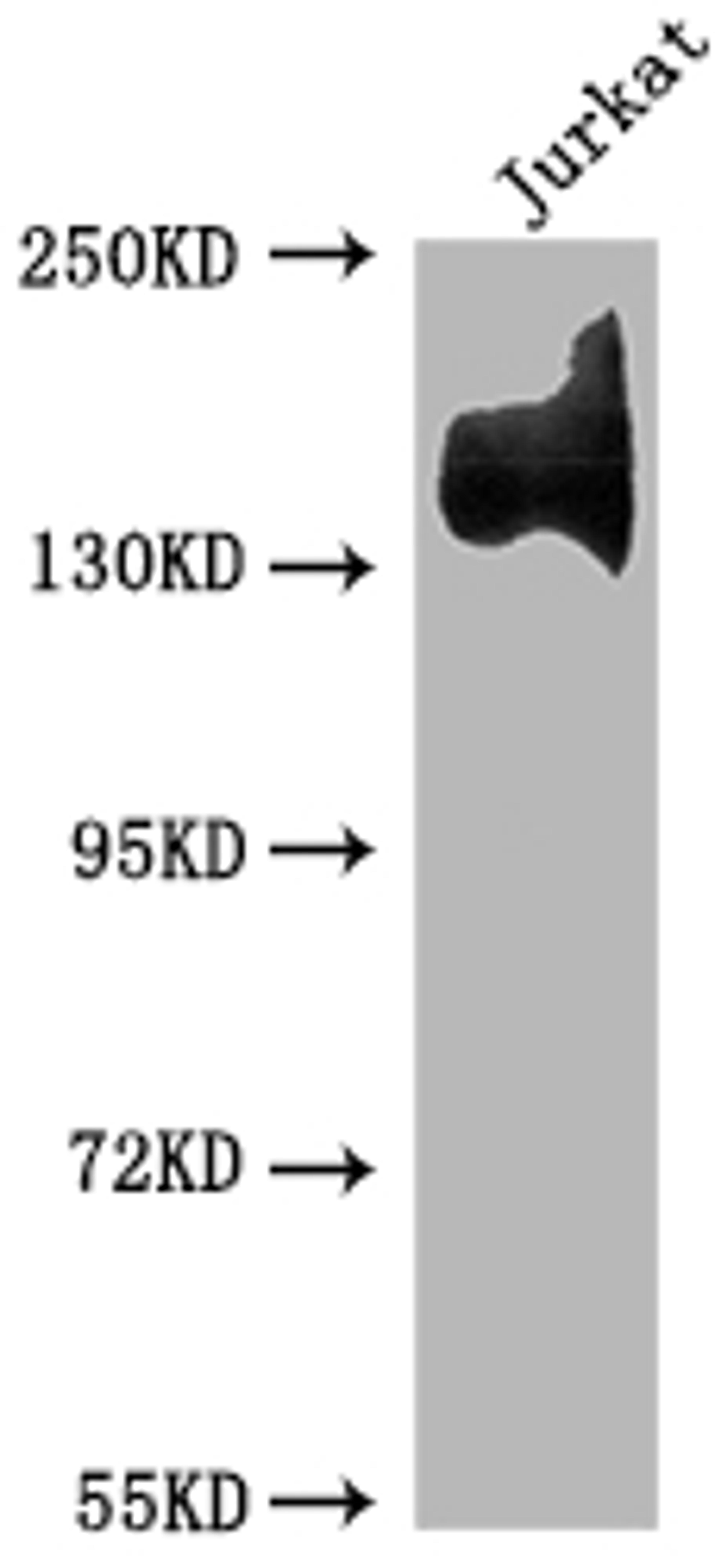 Western Blot. Positive WB detected in: Jurkat whole cell lysate. All lanes: ITGA4 antibody at 1:1500. Secondary. Goat polyclonal to rabbit IgG at 1/50000 dilution. Predicted band size: 115, 26 kDa. Observed band size: 140 kDa.