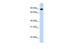 Antibody used in WB on recombinant STAT6 protein at 0.2-1 ug/ml.