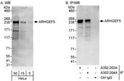 Detection of human ARHGEF5 by western blot and immunoprecipitation.