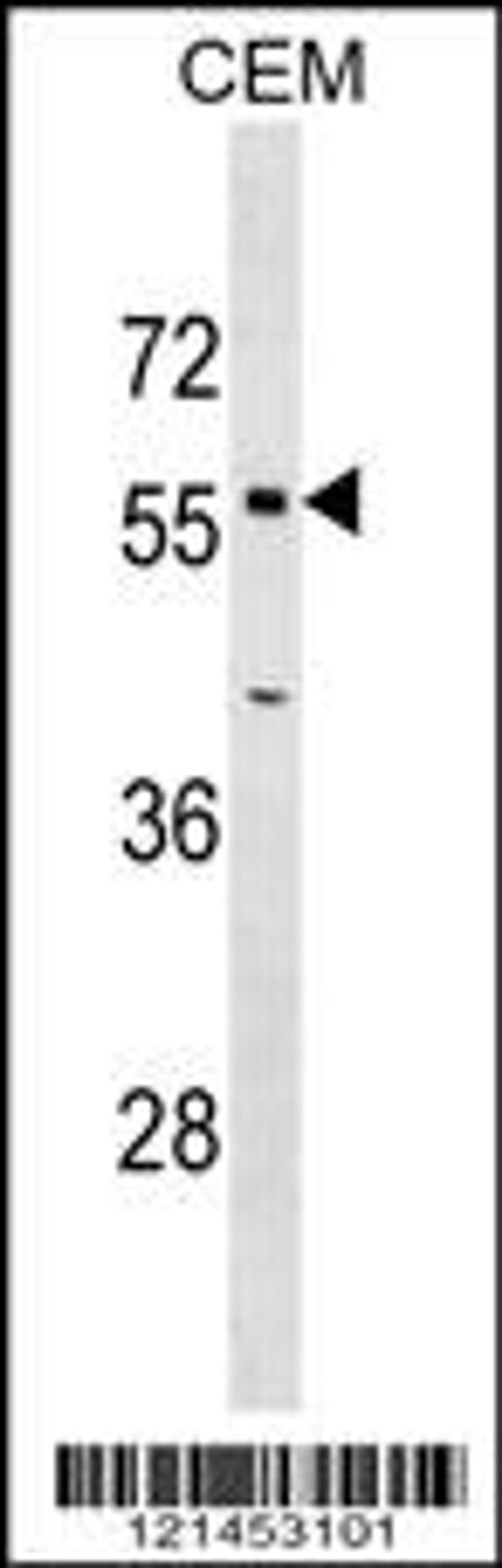 Western blot analysis in CEM cell line lysates (35ug/lane).