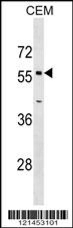 Western blot analysis in CEM cell line lysates (35ug/lane).