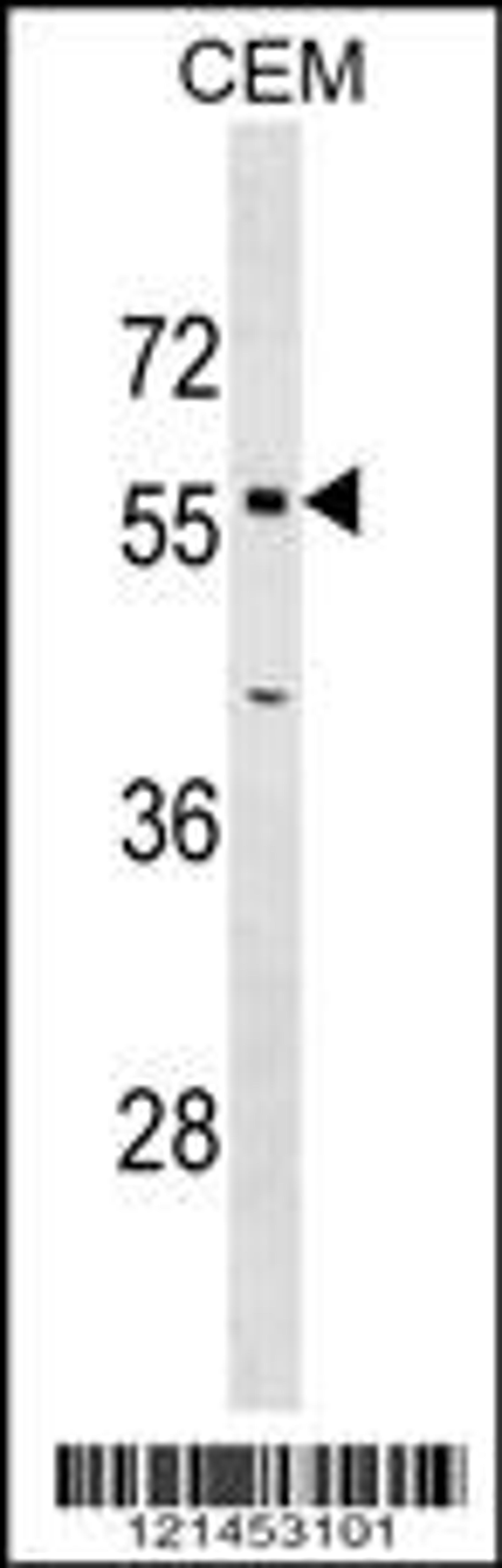 Western blot analysis in CEM cell line lysates (35ug/lane).