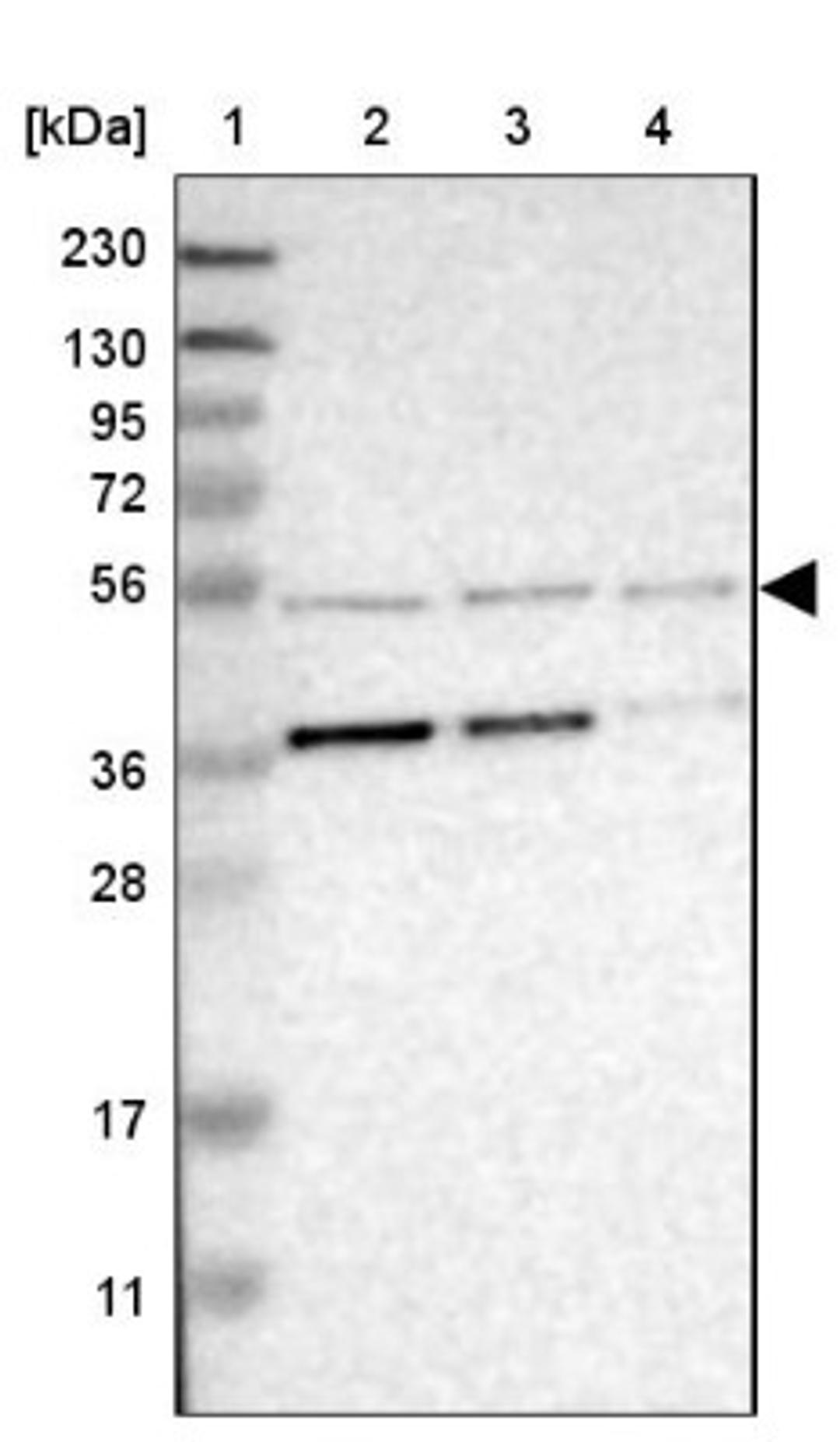 Western Blot: CPOX Antibody [NBP1-85479] - Lane 1: Marker [kDa] 230, 130, 95, 72, 56, 36, 28, 17, 11<br/>Lane 2: Human cell line RT-4<br/>Lane 3: Human cell line U-251MG sp<br/>Lane 4: Human plasma (IgG/HSA depleted)