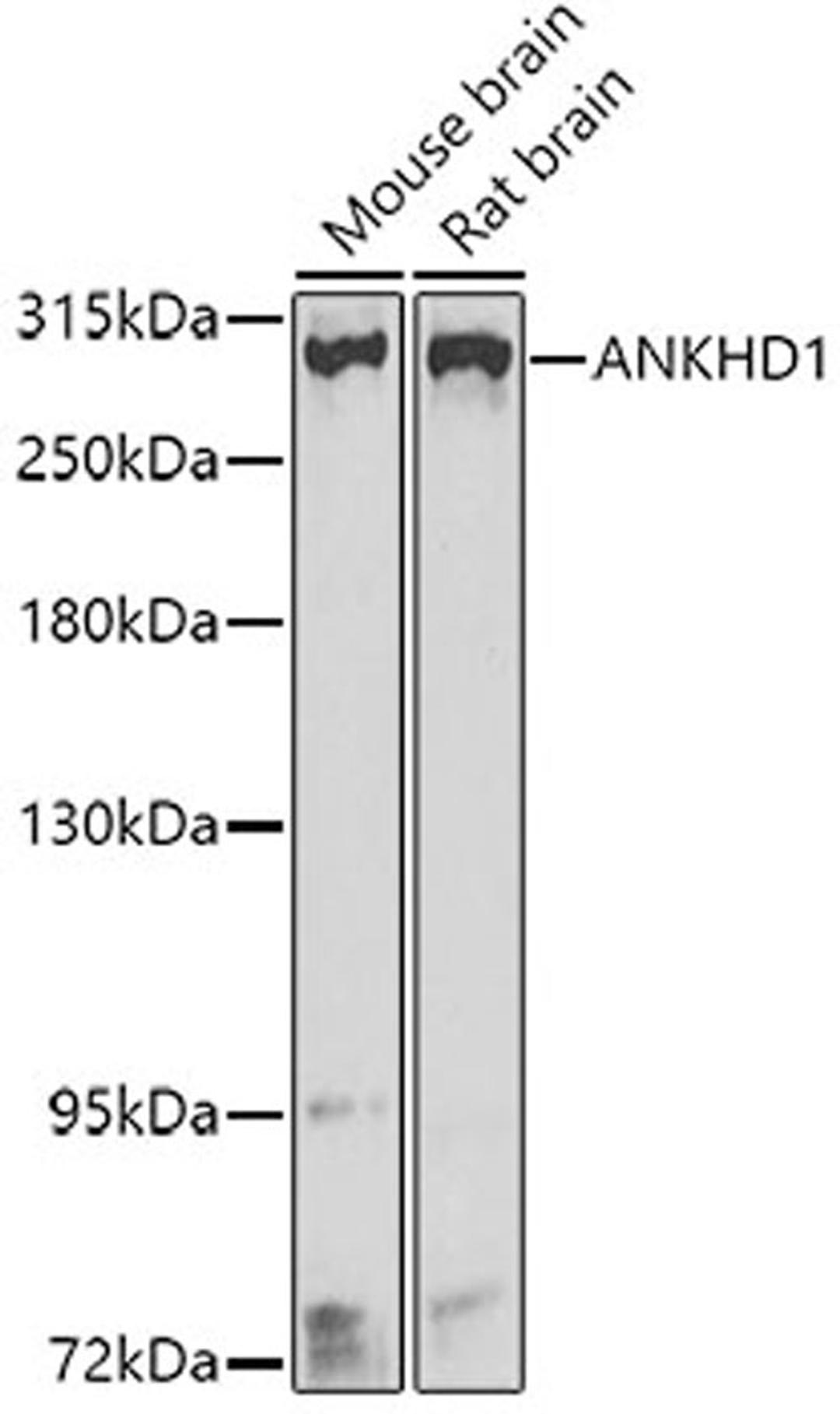 Western blot - ANKHD1 antibody (A8224)