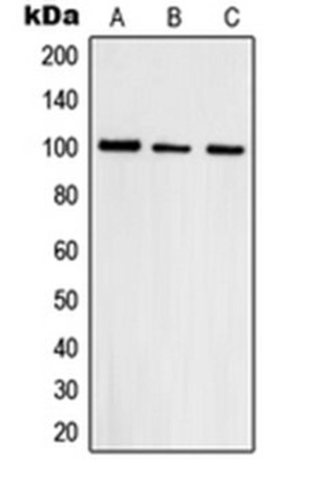 Western blot analysis of HepG2 (Lane 1), A431 (Lane 2), HeLa (Lane 3) whole cell lysates using TOP3B antibody